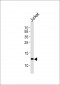 B2M Antibody (C-term)