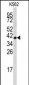 FBL Antibody (Center E120)