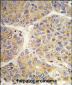 AASS Antibody (Center)