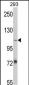 AASS Antibody (Center)