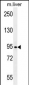 AASS Antibody (Center)