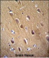 NSE Antibody (Y236)