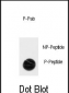 Phospho-ACK1(Y518) Antibody