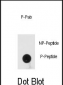 Phospho-PRKRA(S246) Antibody