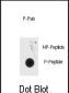 Phospho-MeCP2(S80) Antibody