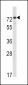 AMHR2 Antibody (C-term)