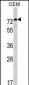 AMHR2 Antibody (C-term)