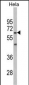 AMPK2 Antibody (Center)