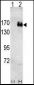 ERBB2 Antibody