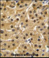 ABL1 Antibody (Center)