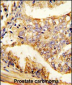 PUM2 Antibody (S182)