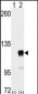 PUM2 Antibody (S182)