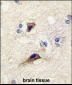 NTF3 Antibody (Center)