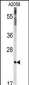 CAV1 Antibody (N-term)