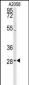 PRKCDBP Antibody (Center)