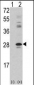 PRKCDBP Antibody (Center)