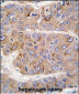 IRS2 Antibody (C-term)