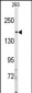 IRS2 Antibody (C-term)