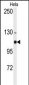 ACTN4 Antibody (N-term)