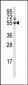 CYP3A5 Antibody (C-term)