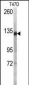 DSG2 Antibody (N-term T160)