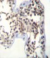 LHB Antibody (C-term)