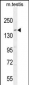 KIT Antibody (N-term D121)