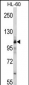 MARS Antibody (C-term)