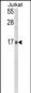 GMFG Antibody (N-term)