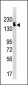 SETDB1 Antibody (C-term)