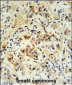 mouse BID Antibody (S61)