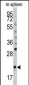 mouse BID Antibody (S61)