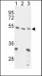 FOXP3 Antibody (C-term)