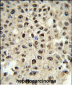 SSB Antibody (N-term)