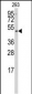 SSB Antibody (N-term)