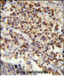 U2AF1 Antibody (Center Y114)