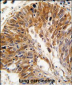 PSMD11 Antibody (C-term)