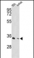 PSMD11 Antibody (C-term)