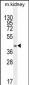PSMD11 Antibody (C-term)