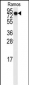 DLG7 Antibody (N-term)