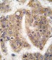 TRAIP Antibody (C-term)