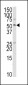 TRAIP Antibody (C-term)