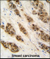 XTP3TPA Antibody (N-term)