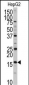 XTP3TPA Antibody (N-term)