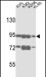 ABCB5 Antibody (N-term)