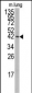 MAPK14 Antibody (T180/Y182)