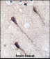 PUM1 Antibody (Y83)
