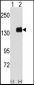 PUM1 Antibody (Y83)
