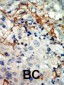 EphA3 Antibody (N-term)