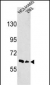 EphA3 Antibody (N-term)
